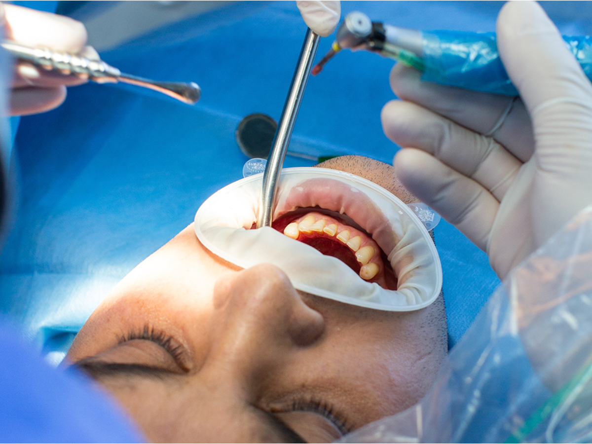 Cirurgia Guiada por Computador: Mais Precisão, Menos Incômodo